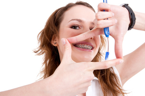 What Is A Poking Wire In Braces and Orthodontics? - ArchWired