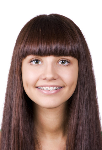 Girl with Bangs and Braces John A Gerling DDS in McAllen TX