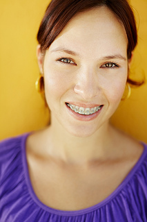Young woman with braces